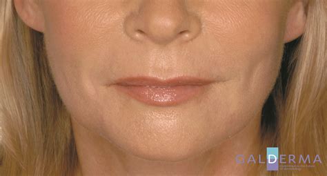 cosmetic injections glenelg|MEDICINE OF COSMETICS .